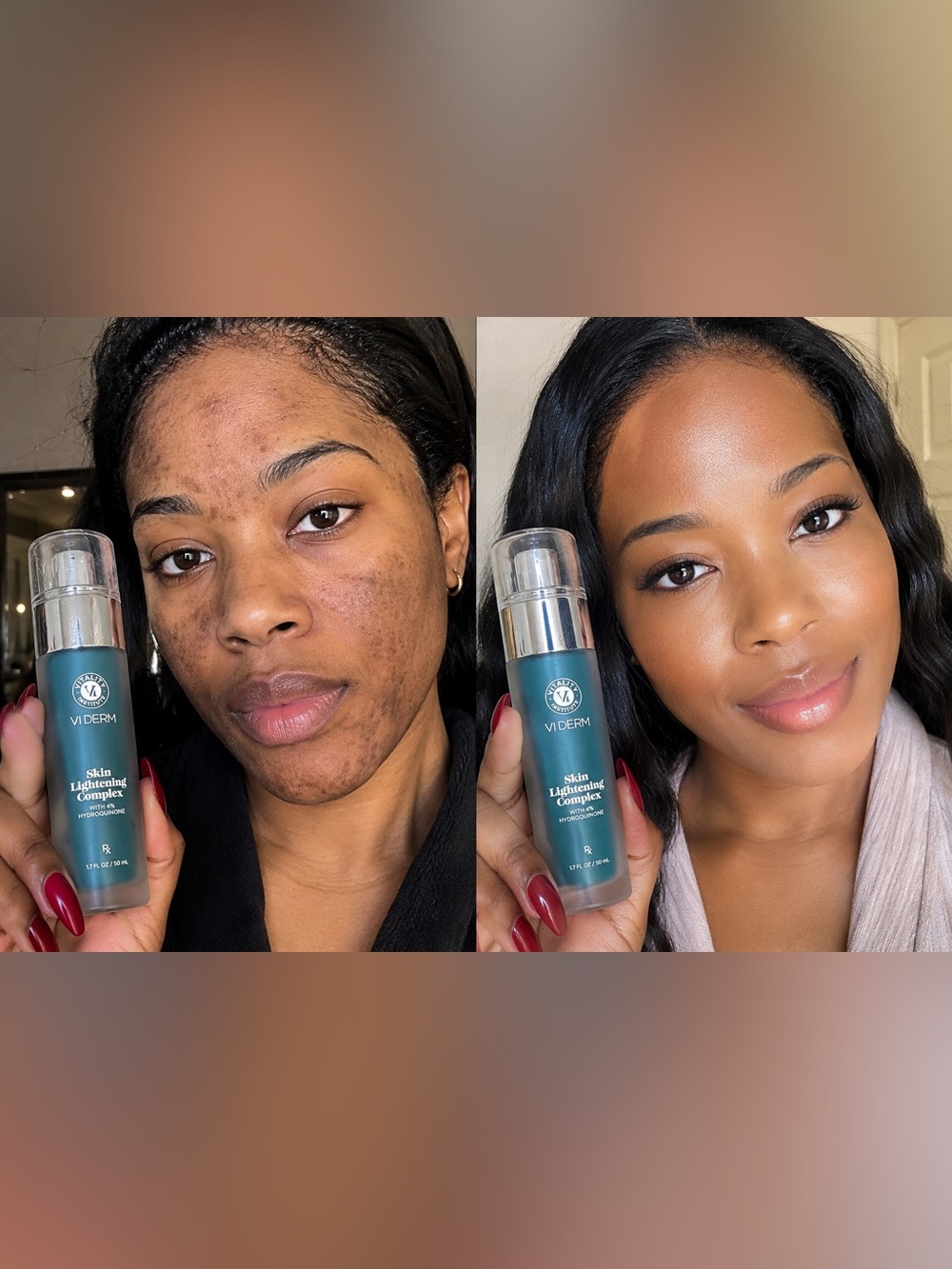 Bi Skin Skin Lightening Complex - for dark spots